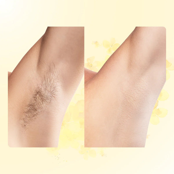 Slower, Finer Regrowth